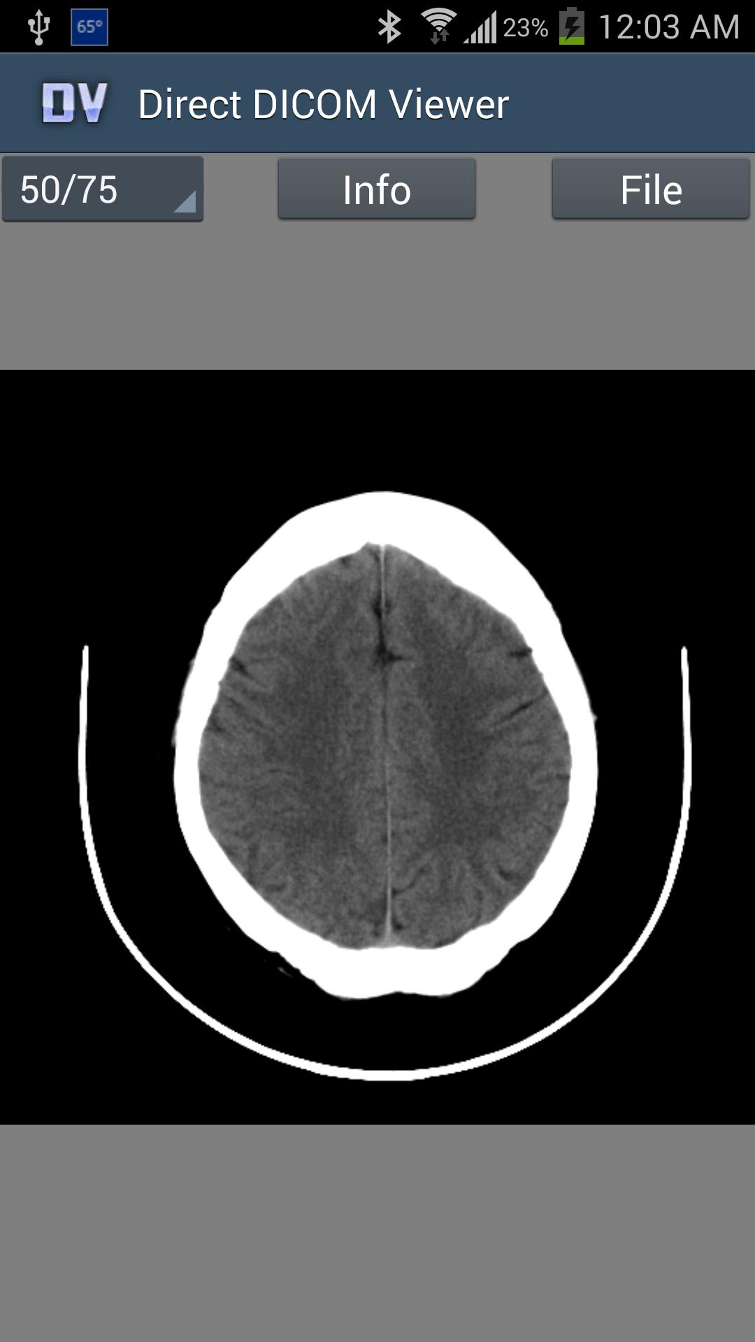 Direct DICOM Viewer
